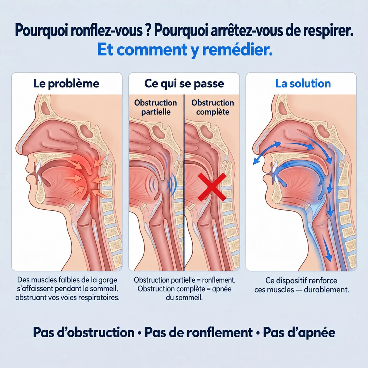 Dispositif intelligent anti-ronflement